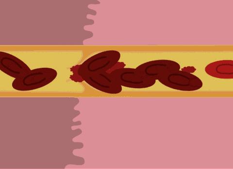 血管好不好，摸摸这里就知道！