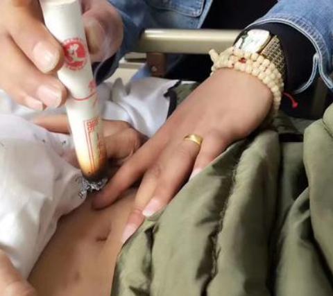 三伏治妇科，事半功倍！附件囊肿、盆腔积液、宫寒肌瘤，一灸全好。