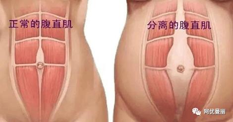 产后修复的重要性、训练方法和注意事项！【甄爱瑜伽分享】