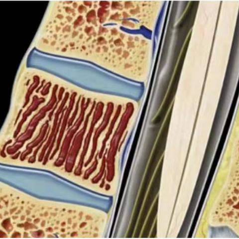 检查椎体血管瘤，无症状莫担心。
