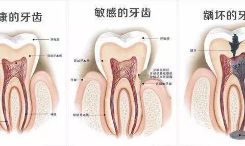 口腔健康测试，9题全中，请自觉去看牙