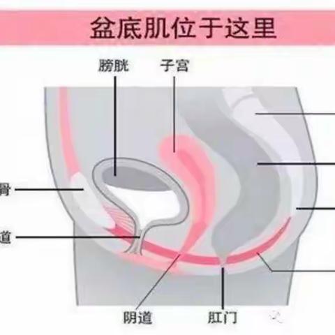 盆底治疗到底多重要