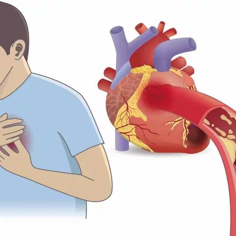 冠心病与糖尿病的关系