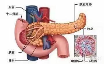 血浆置换～～于一例重症急性胰腺炎的救治