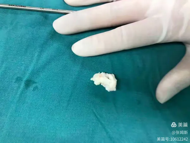 包含湖南中医学院第二附属医院（湖南省中医院）当天就能挂上号的词条