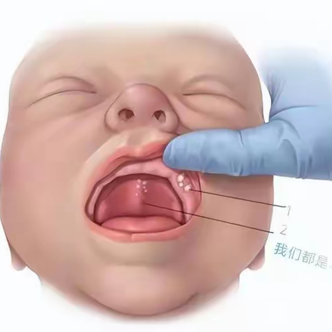 新手爸妈须知——新生儿常见的生理现象