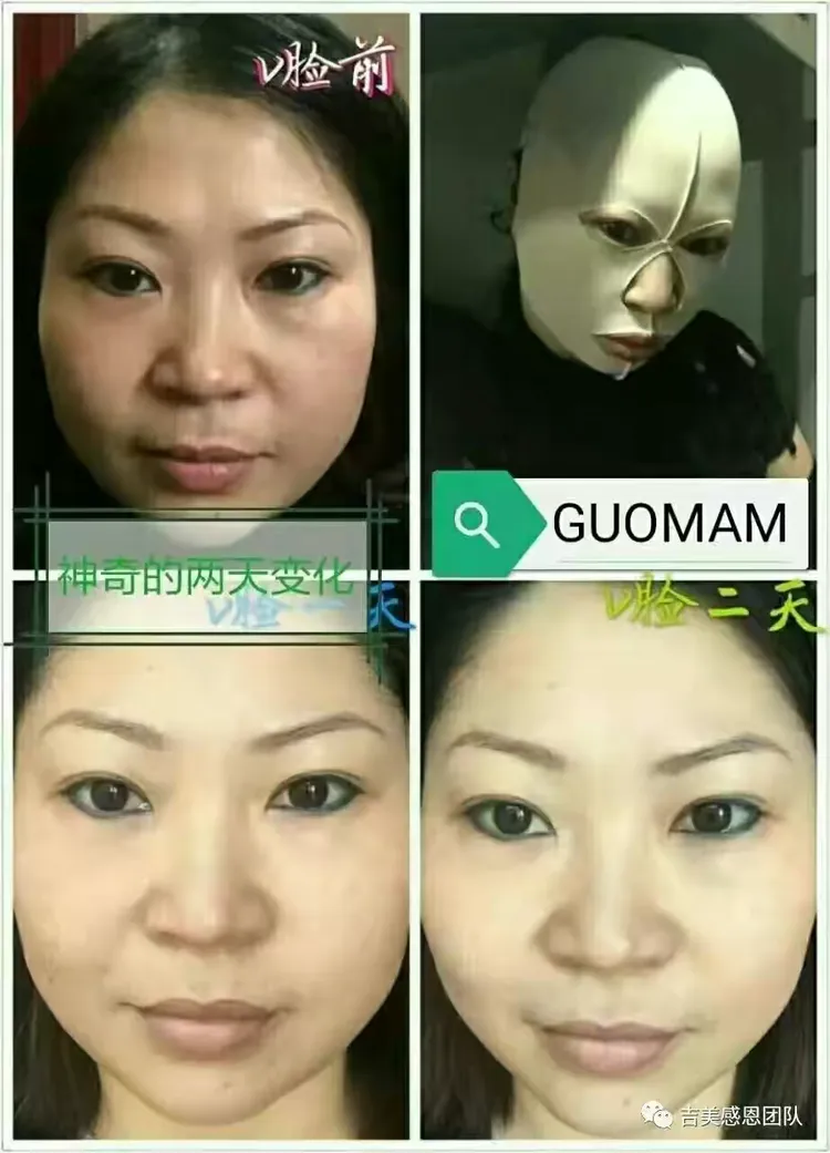 吉美v脸,一款打破护肤美容行业一个颠覆性的核武器,真正践行科技回归