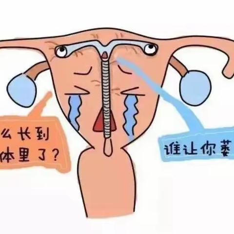 超期服役的节育器该不该取出