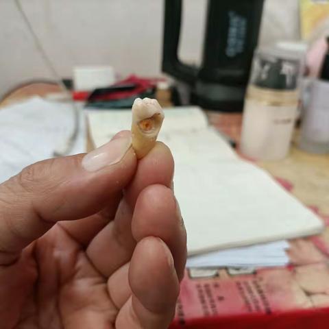 蛀牙的悲哀