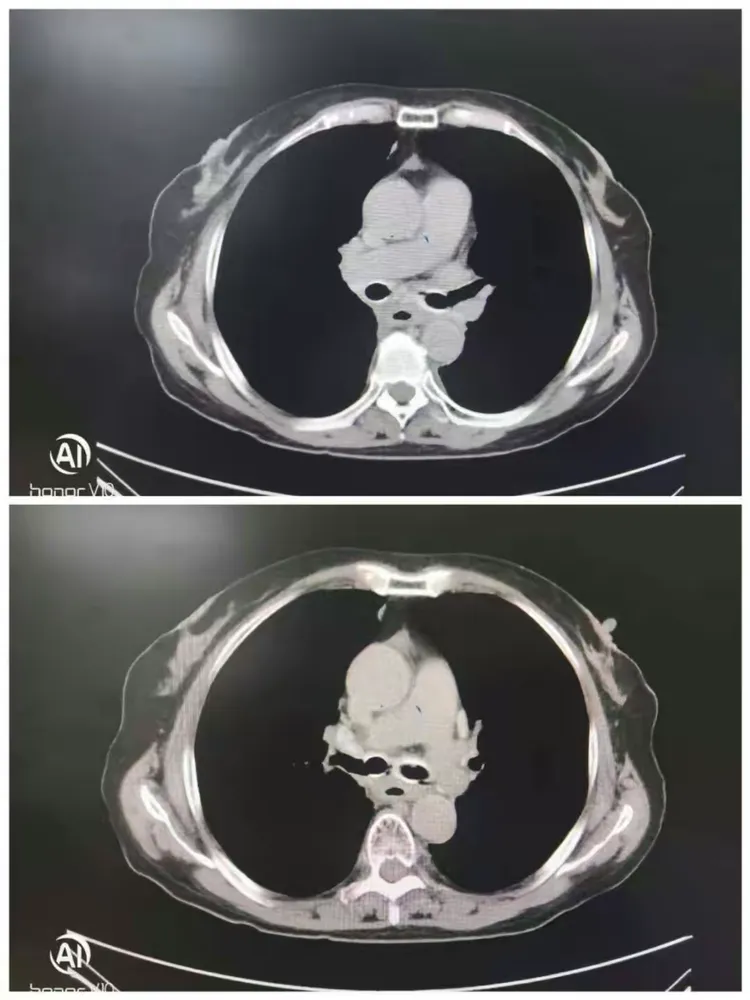 阜外醫(yī)院掛號途徑CT加急-阜外醫(yī)院掛號途徑ct加急核酸 