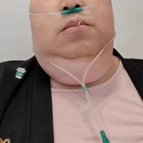 中晚期胸腺癌--中西医结合治疗显疗效