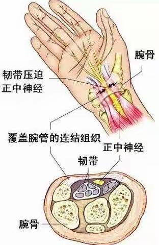 【南沙区第一人民医院 骨科病例分享】