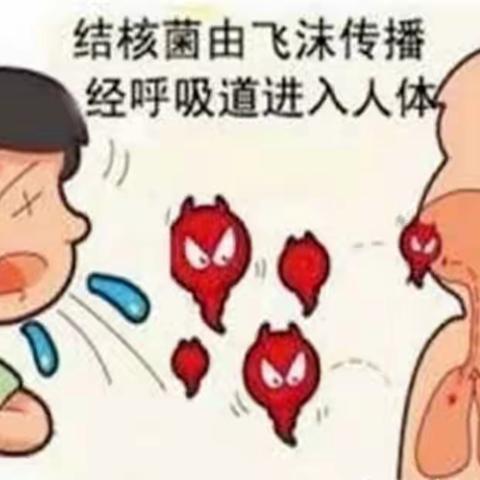 终结结核流行、自由健康呼吸