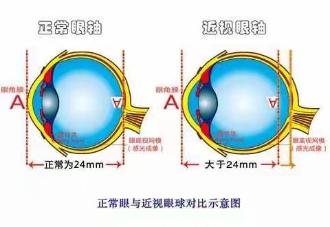 眼镜店专业知识100问100答（一）【眼镜公益课堂】