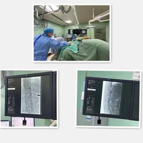 我院针灸疼痛科成功行首例胸椎间盘突出射频热凝手术