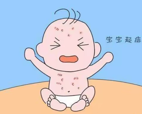 宝宝夏日防痱之痱子护理指南！