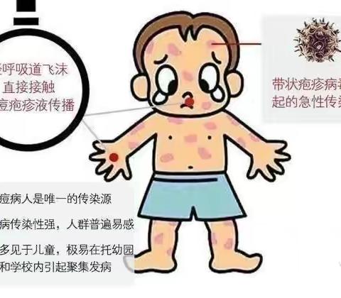 预防水痘至家长一封信