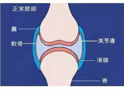 健康科普知识之一：膝关节关节积液