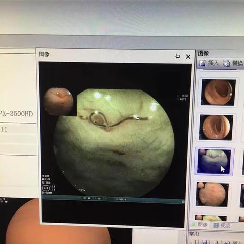 小小寄生虫  健康拦路虎