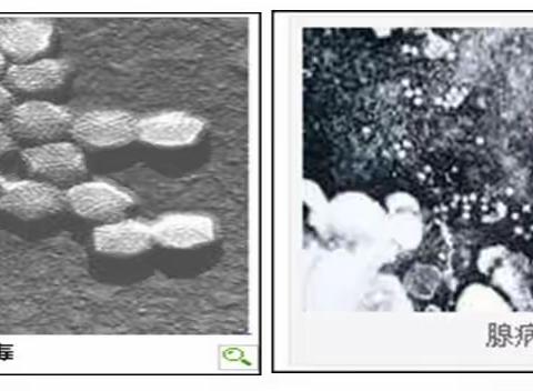 腺病毒感染疾病防治知识问答
