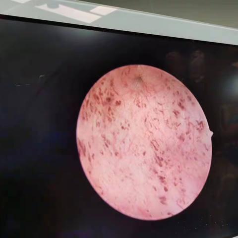 青岛专家刘小强援西和县人民医院妇产科记实一一你是那星空中最亮的星星，照亮我一路前行！