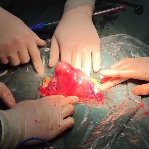 青岛产科专家于洋老师和生殖、内分泌专家刘小强博士在我科指导工作。