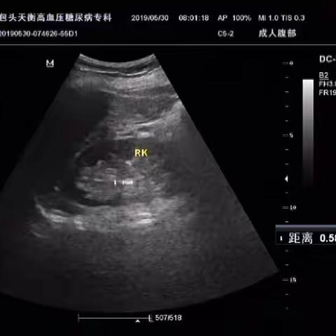 彩超存在测量问题6.21