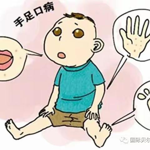 幼儿园手足口病预防宣传保健知识