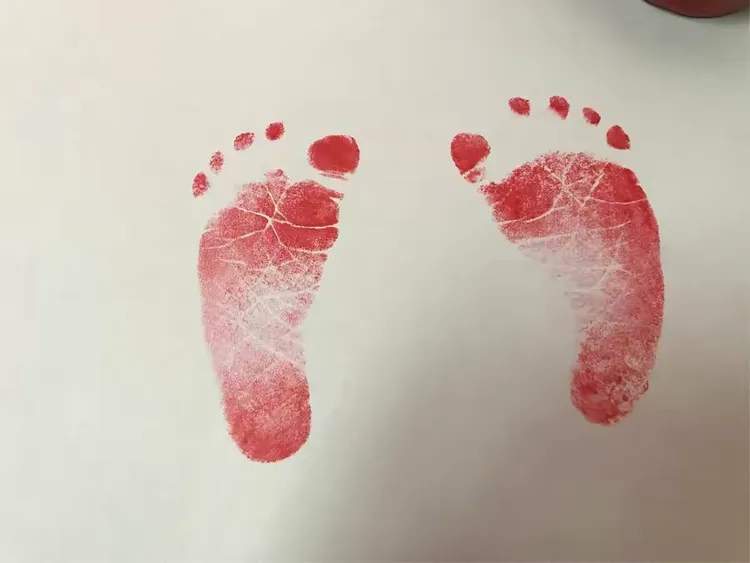 医生给你戴上写有妈妈名字的手环,印了小脚印。医生说:孩子的足印很清晰,说明是足月出生的。