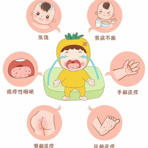 碧洲阳光幼儿园致家长：秋季手足口病温馨提示