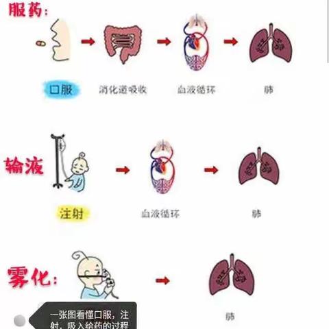 鄂前旗人民医院儿科雾化开启新模式