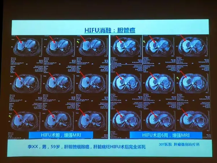 北京307医院、海淀区网上预约挂号，预约成功再收费