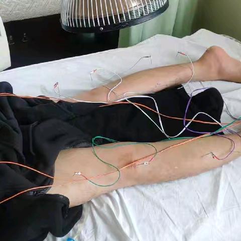 中医赋能—截瘫患者逐光历程