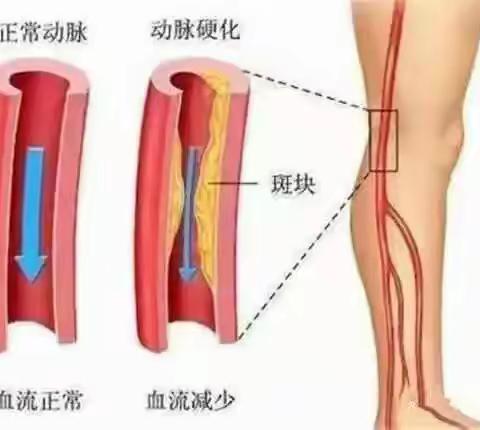 醋泡花生、喝红酒、吃黑木耳等等，这些妙招真的有用吗？从营养角度分析一下。