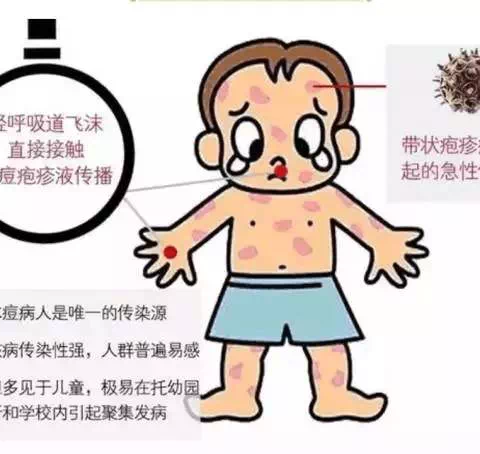 认识水痘，一起“战痘”，校园防控健康小课堂（二）——海阳小学