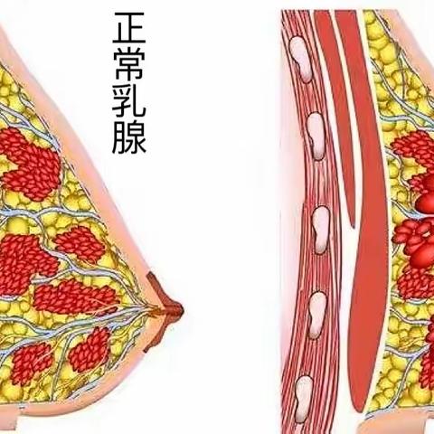 乳腺增生、痛经患者的福音来啦❗️❗️❗️