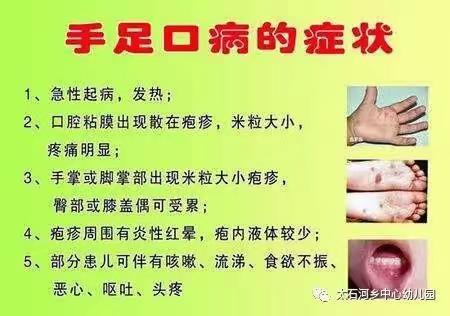 关于“手足口病的预防与防治常识”告家长书