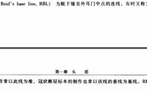 断层解剖