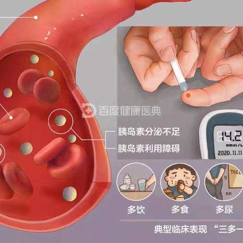 讲述百味糖事，营造健康生活——椿林镇卫生院