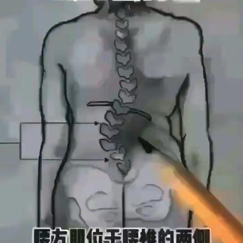 腿疼是哪的问题？