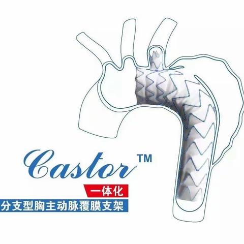 鄂尔多斯市中心医院胸心血管外科独立完成Castor一体式分支型主动脉覆膜支架