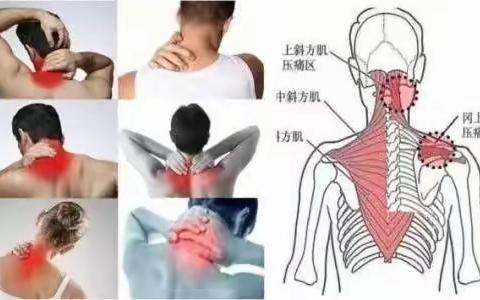 如何缓解颈椎痛的五种方法！
