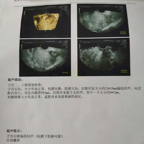 保护子宫，以微取胜