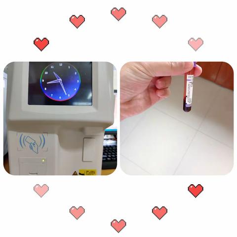 石泉县中医院检验科开展新项目