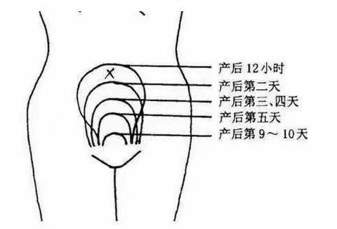 中西医合璧共克产后恶露不绝共克产后妊辰纹