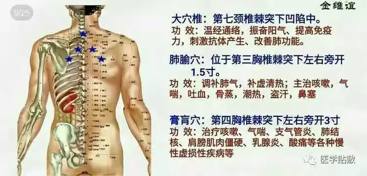 哮喘病采用七大主穴+双定喘穴