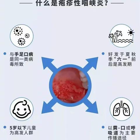 如何预防疱疹性咽颊炎