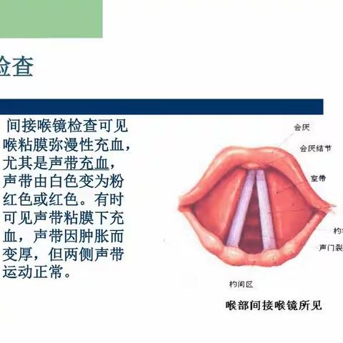 科普小儿急性喉炎