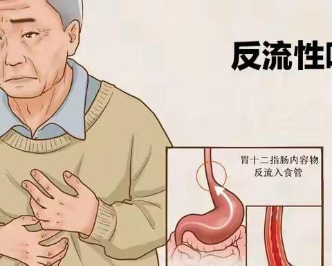 反流性咽喉炎，您了解吗？