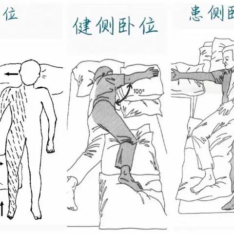 【周医·急诊与重症医学病区】良肢位的摆放，您做对了吗？